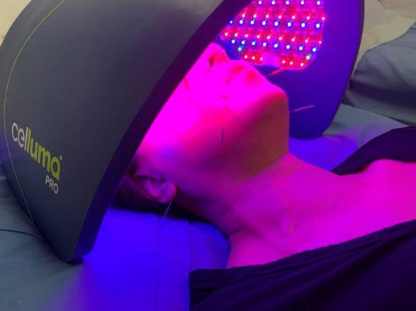 An Expert Discussion: Combining Light Therapy With Acupuncture For Acne & Aging